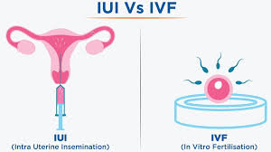 Does Ivf Overcome Fertility Problems?