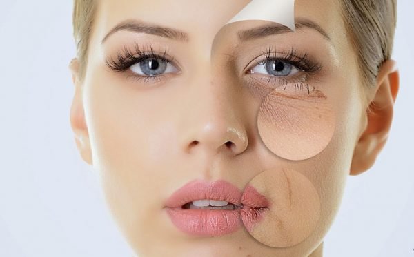 Căng da mặt bằng chỉ (Căng chỉ collagen hay còn gọi là căng chỉ sinh học) là phương pháp trẻ hóa không xâm lấn, dùng các sợi chỉ sinh học để đưa vào bề mặt dưới da, nâng đỡ các khối cơ