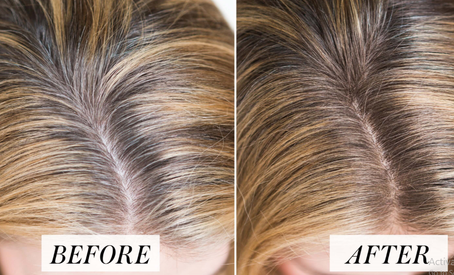 before after using Natural Anti Grey Hair Treatment