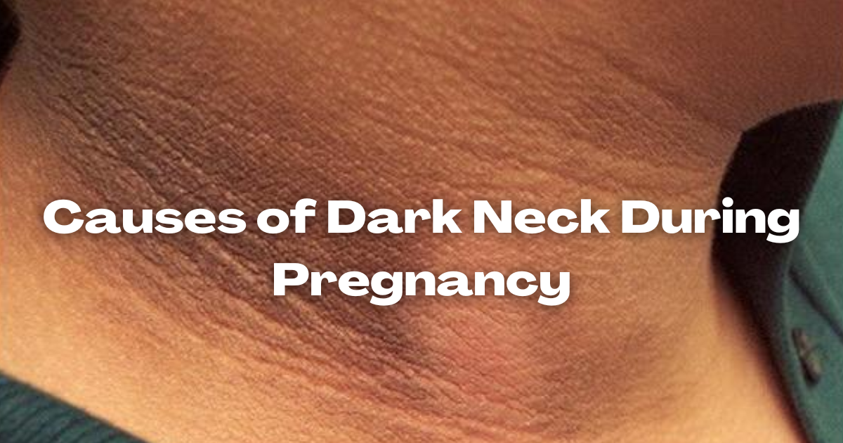 Causes of Dark Neck During Pregnancy