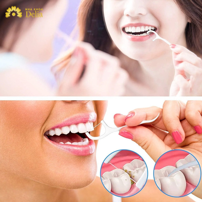 Sử dụng chỉ nha khoa để bảo vệ răng tốt hơn 
