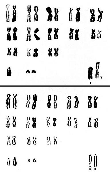 Chromosomes of male and female kudus