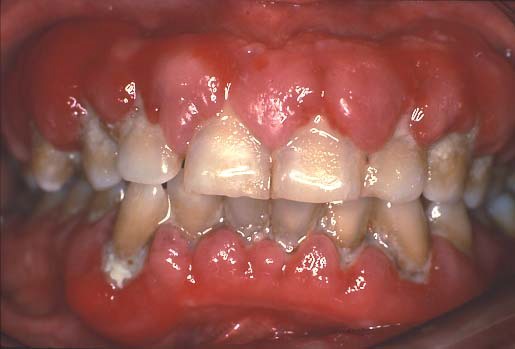 rare dental cases