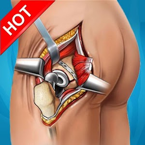 Virtual Surgery - Hip Surgery apk Download