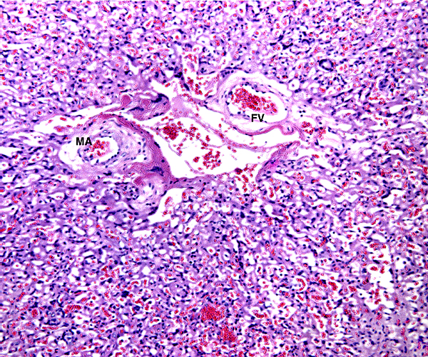 Center of lobule in mature placenta with maternal artery (MA) and fetal vein (FV).