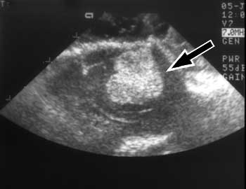 Sagittal, intraoperative ultrasonographic image of a dog with cerebral meningioma