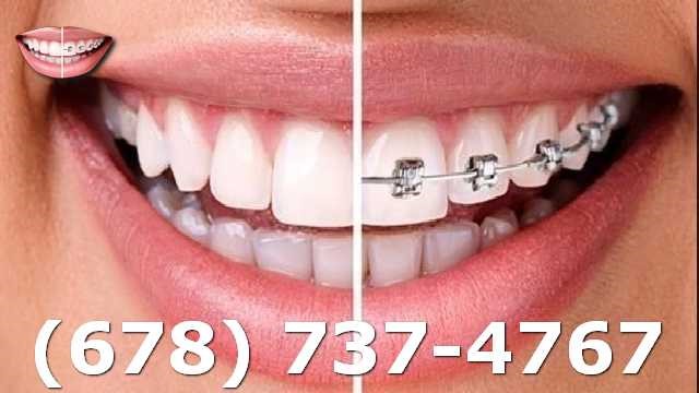 Orthodontists Atlanta