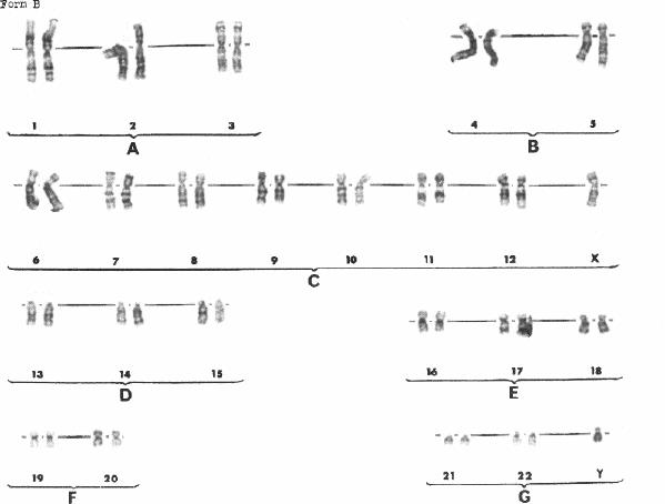 G-banded karyogram (karyotyping image) with characteristic banding pattern on each chromosome, which makes chromosomal anomalies visible