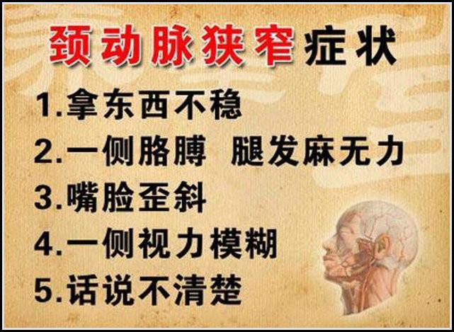 专家：血管老化和去除动脉粥样硬化斑块的方法 - 閒靜 - √