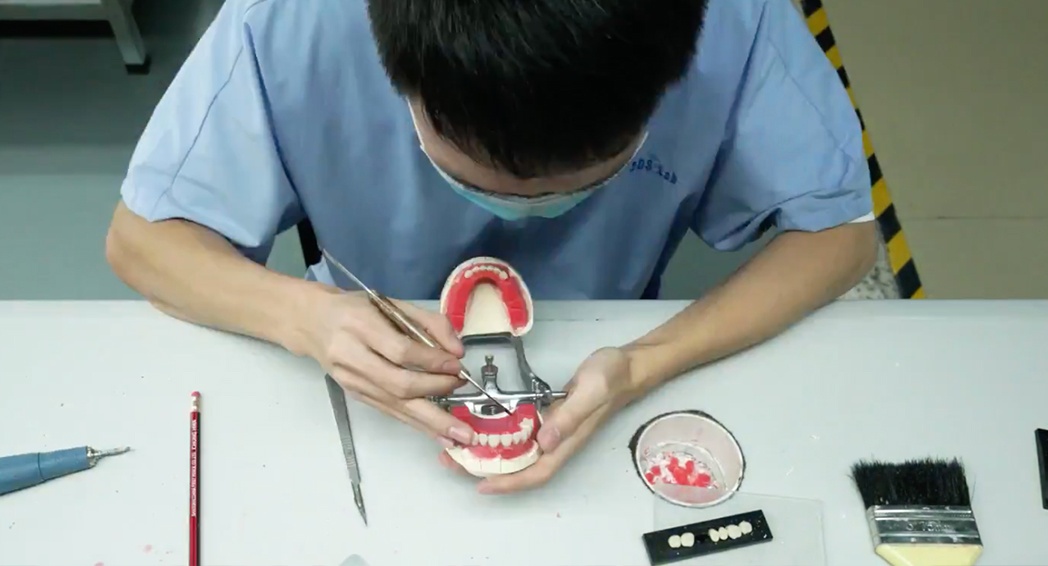 Denture Fabrication - Tooth Set-Up