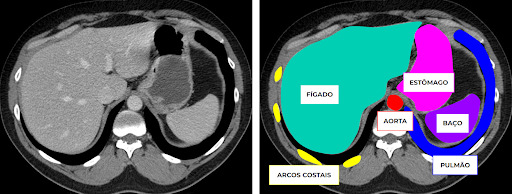 Anatomia tomográfica do abdome