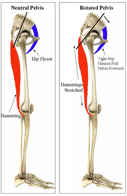 Hamstring Pain with Running, Hiking and XC Skiing - Pain ...