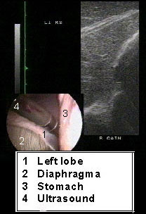 Laparoscopic ultrasound of the left liver in a standing pony.
