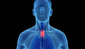 Esophagus Pathology