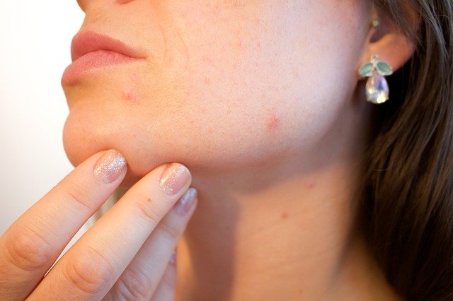 Skin Problems in hindi