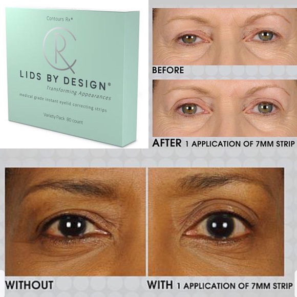 eye lift before and after - Lide By Design - Correcting strips