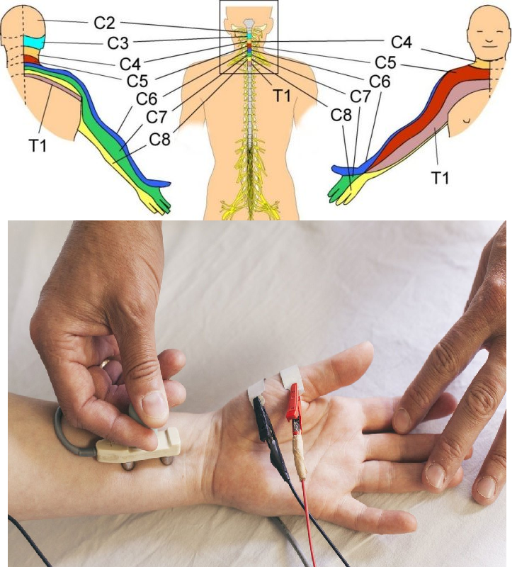 Boyun fıtığı ve EMG