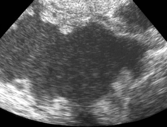 Ultrasound scan of a cat with a pancreatic pseudocyst