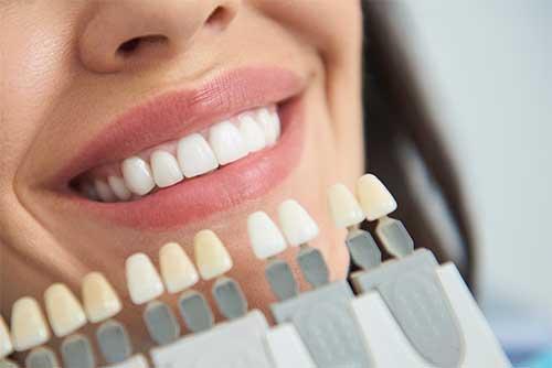 teeth whitening services in Toronto