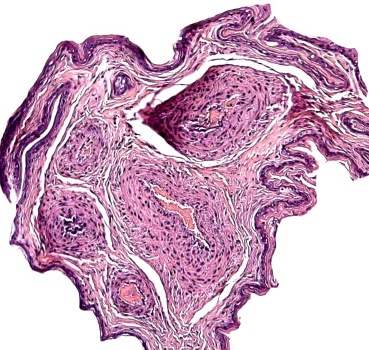 Umbilical cord of this bat's placenta
