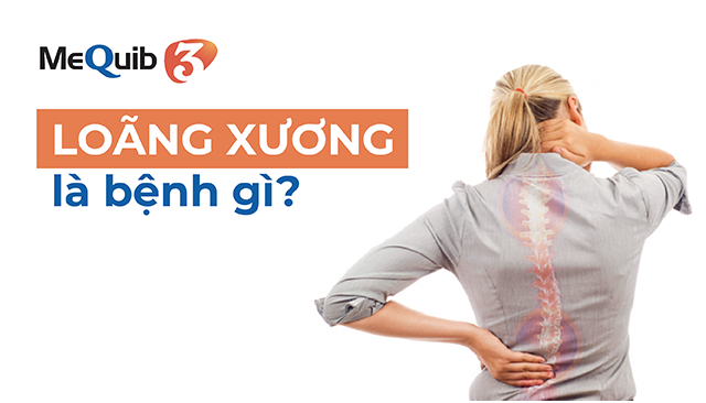 Chăm sóc sức khoẻ: NHỮNG TIPS HIỆU QUẢ ĐỂ PHÒNG NGỪA LOÃNG XƯƠNG Ở NGƯỜI TRẺ TUỔI HIỆU QUẢ PY-fJECyZesrosyFpwkUcdrrkkZ60JUbSmk6xgnd4C6f2Dm4vrlXirw4TdEk3Gp1BoAy0i7ggoxomsoAMX2NCooQ-0fLStrelr8Es1L5koXew5OmjO5Dzyj0faLrywClywxWYtnY