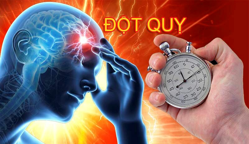 dược phẩm chống đột quỵ của mỹ