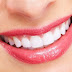Niềng răng là gì? Các phương pháp niềng răng phổ biến nhất