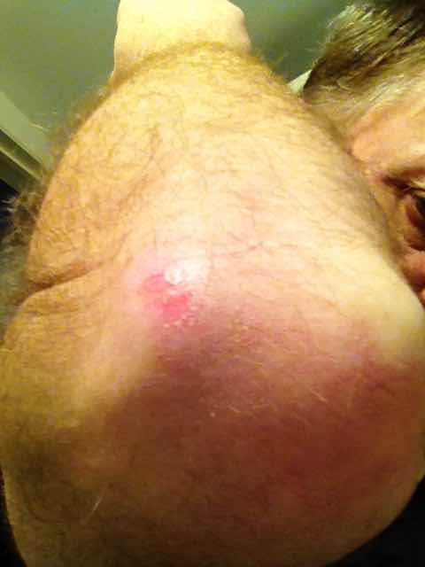 Elbow