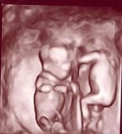 DS - 3d ultrasound.jpg
