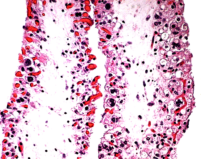 Higher magnification of villi with several typical binucleate cells