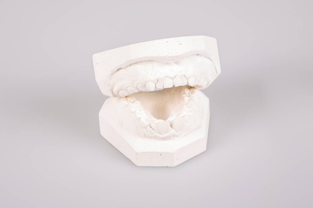 Dental Implant Solutions for Modern Smiles