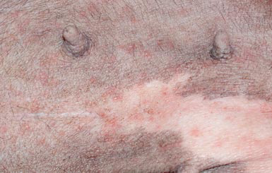 Papular lesions of superficial pyoderma in an atopic French Bulldog