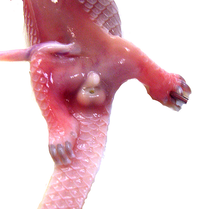 Genitalia of second fetus with descended testes.