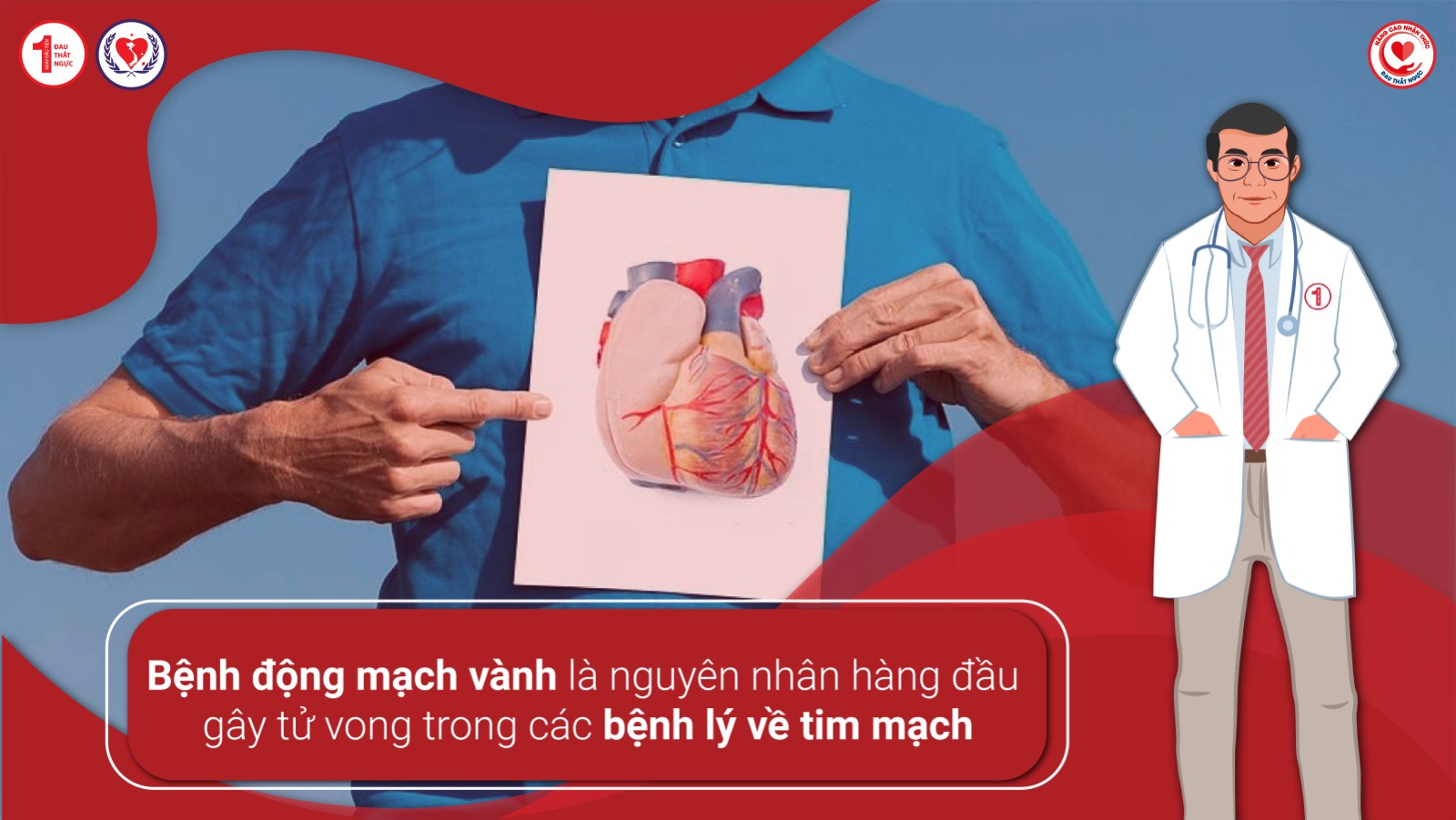 Bệnh động mạch vành là nguyên nhân hàng đầu gây tử vong trong các bệnh lý về tim mạch
