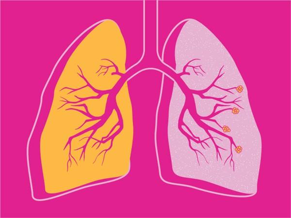 COPD-Wellbeing