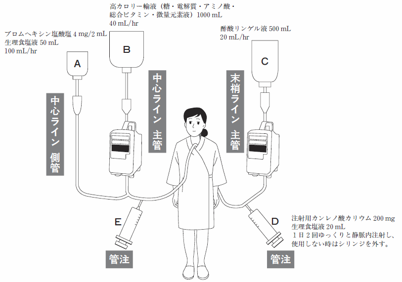 注 アレビアチン