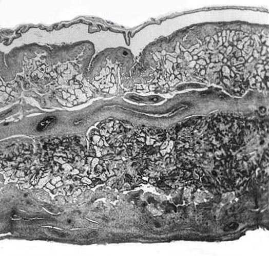 Complete cross sections of mature placenta from black and white ruffed lemur