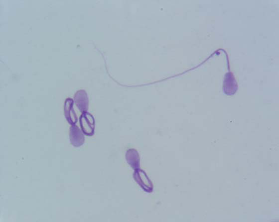 Espermatozoides con colas enrolladas proximales