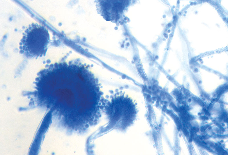 New methylene blue stain of Aspergillus conidiophores from an air sac sample obtained at endoscopy