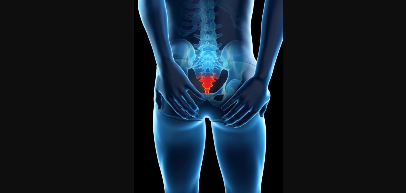 Tailbone pain: Causes, diagnosis, and relief