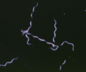 Culture-grown B. burgdorferi organisms shown by dark-filed microscopy.