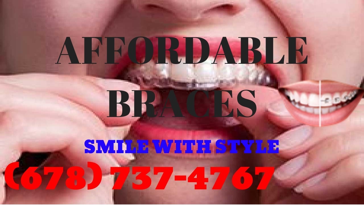 Braces Atlanta