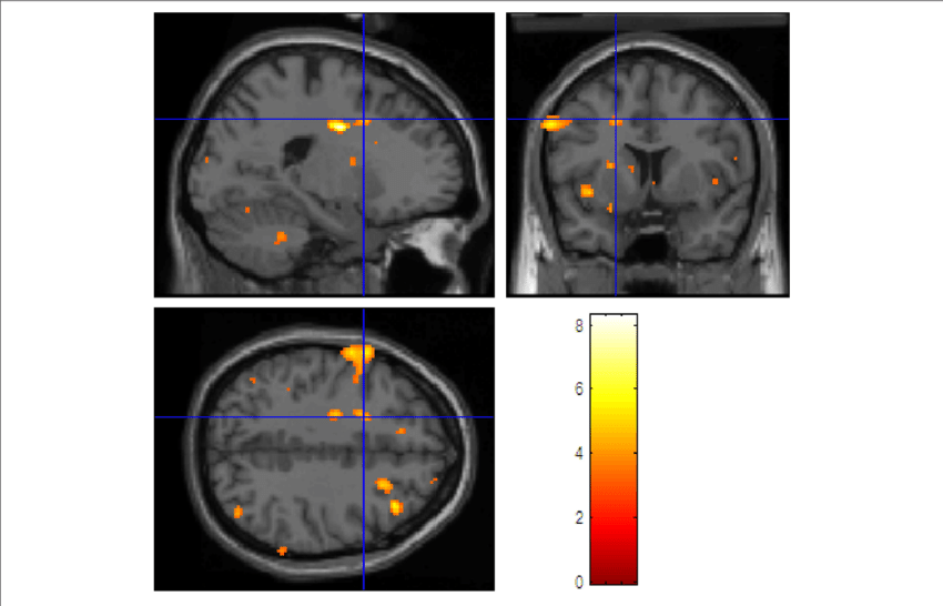 | An example fMri scan showing brain activity.