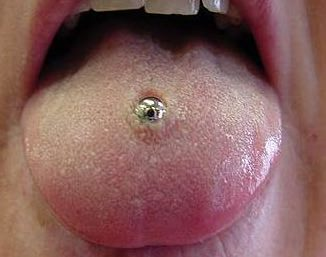 infected tongue piercing 