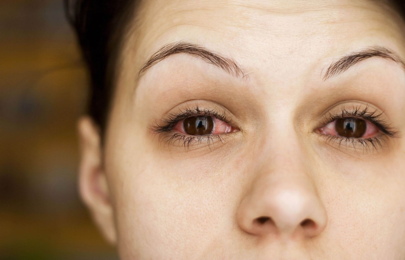a woman with dry eyes in the morning, due to allergies