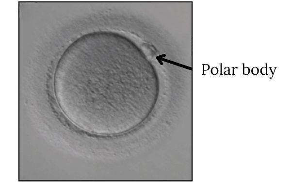 metaphase 2 egg with polar body