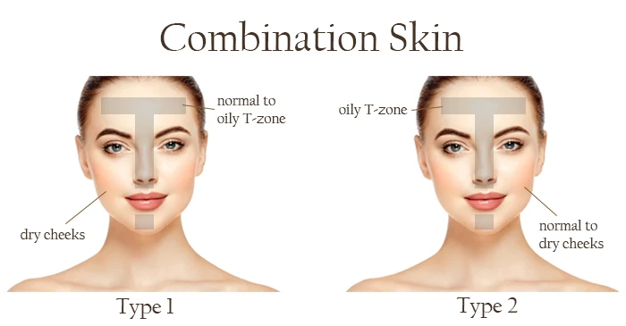 Combination Skin Type.