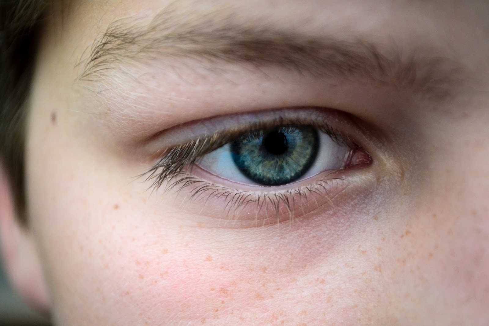 10 remedios caseros efectivos para ojos doloridos y reducir la fatiga…