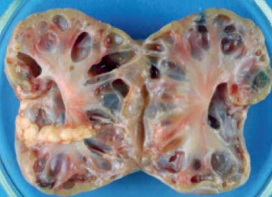 Post-mortem specimen of a kidney taken from a six year old Persian cat euthanazed with end stage kidney disease