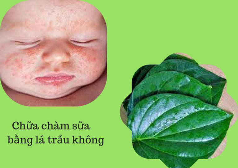 Dùng lá trầu không để trị chàm sữa